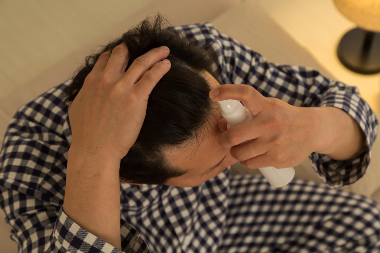 頭皮分線後塗抹養髮液